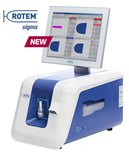 rotem-sigma-product-min